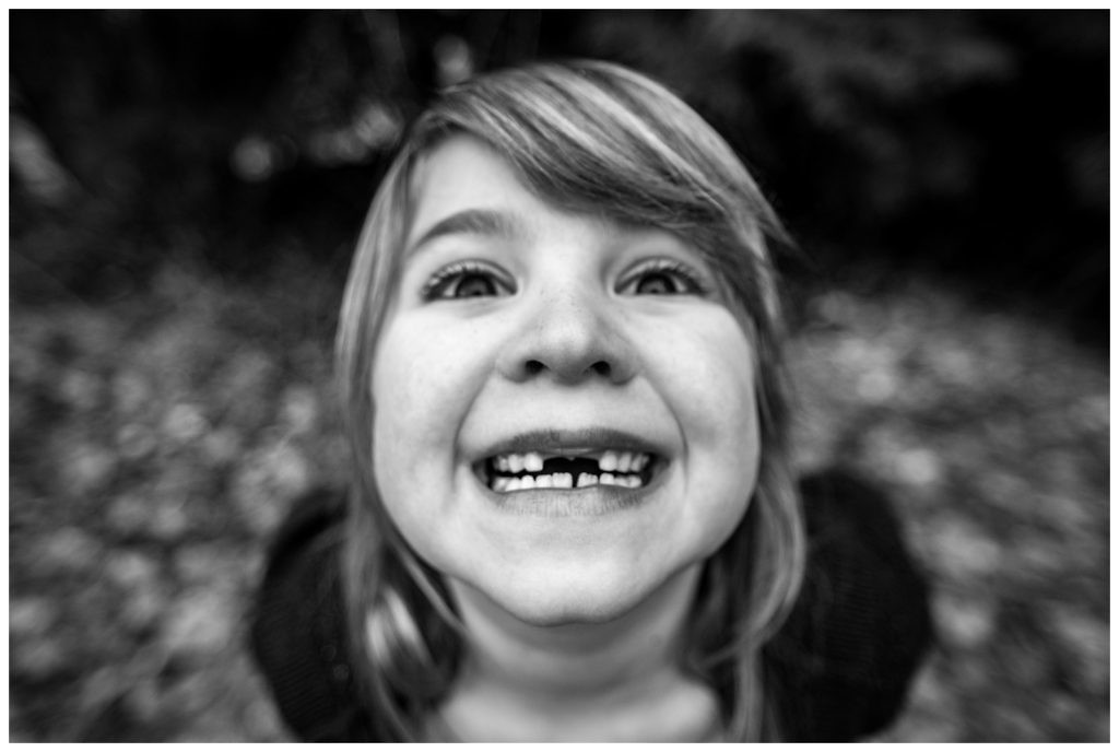 little-girl-with-big-smile-and-missing-front-teeth